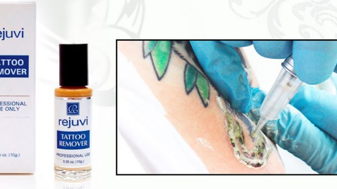Rejuvi Tattoo Remover. Borrar tatuajes sin láser es posible.